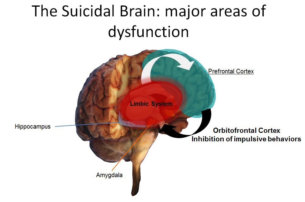 The suicidal brain